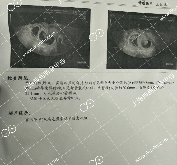 弱精险成怀孕拦路虎 幸遇良医成就“好”孕